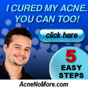 Acne No More