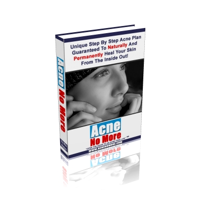Acne Scar Cure : Pimples Cure E-book Shows All